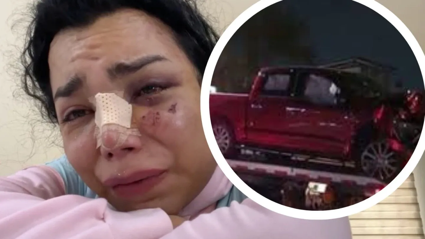 ¡Ni los tacos se salvaron! Paola Suárez reaparece tras aparatoso choque ¡Ni los tacos se salvaron! Paola Suárez reaparece tras aparatoso choque