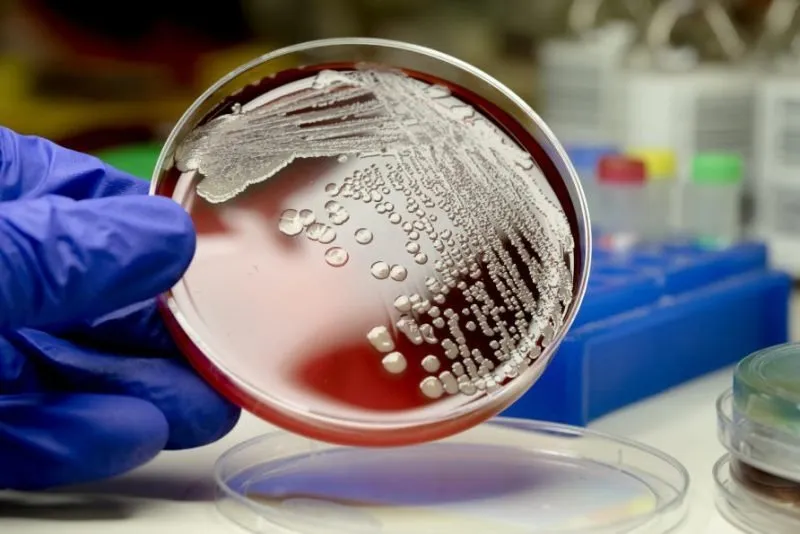 Alerta sanitaria en Estados Unidos: Avanza la propagación de la superbacteria y hongo multirresistente Candida auris en más de 20 estados Alerta sanitaria en Estados Unidos: Avanza la propagación de la superbacteria y hongo multirresistente Candida auris en más de 20 estados