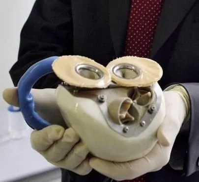 Revolución en la bioingeniería: Desarrollan el primer corazón mecánico portátil capaz de latir de forma continua sin necesidad de trasplante Revolución en la bioingeniería: Desarrollan el primer corazón mecánico portátil capaz de latir de forma continua sin necesidad de trasplante