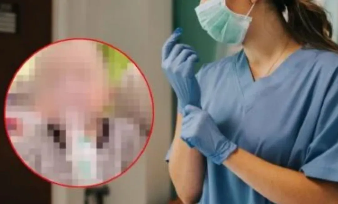 Enfermera corta el dedo a un bebé al retirarle un vendaje con tijeras en un hospital Enfermera corta el dedo a un bebé al retirarle un vendaje con tijeras en un hospital