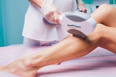 Cuáles son los efectos secundarios de la depilación láser