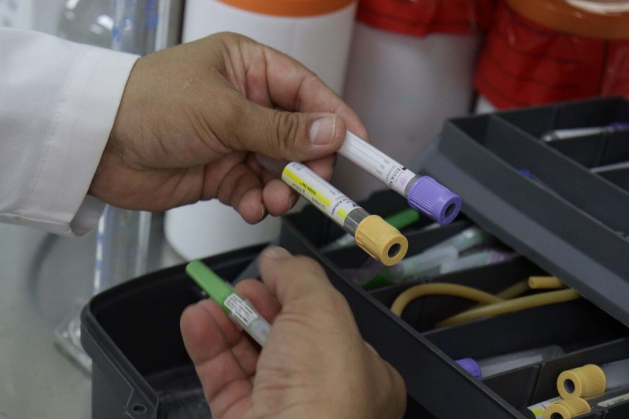 El tipo de alimentación es determinante en la aparición de cálculos renales: especialistas en medicina y nutrición