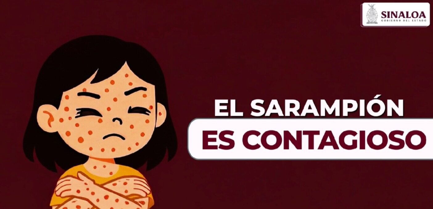 Secretaría de Salud de Sinaloa reitera llamado a vacunarse contra el sarampión