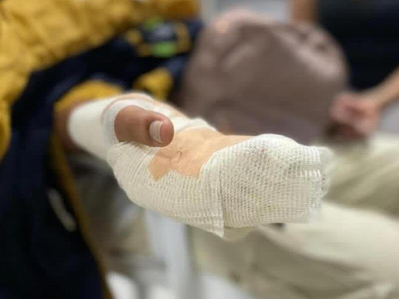 PC  Sinaloa reporta nueve personas heridas por pirotecnia en la temporada decembrina
